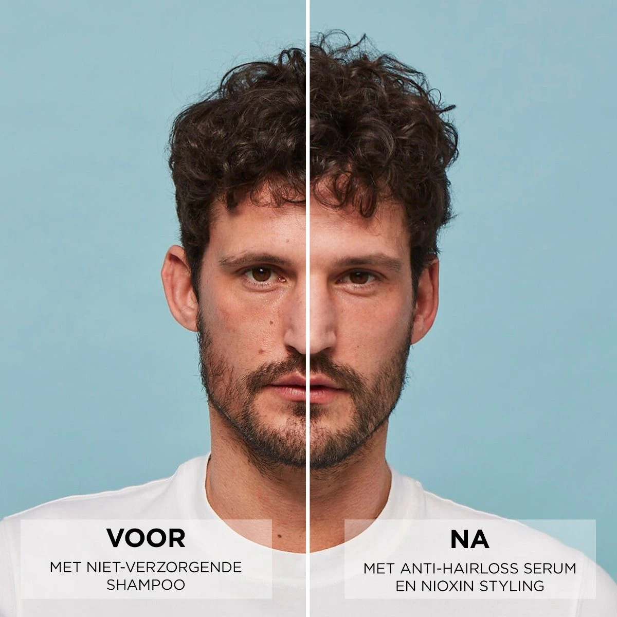 Nioxin Anti-Hairloss Serum 70ml 4 Nioxin Anti-Hairloss Serum 70ml - Afbeelding 4