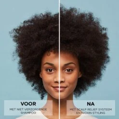 Nioxin Scalp Relief Conditioner 200ml 7 Nioxin Scalp Relief Conditioner 200ml -L'Oreal Verkoop nioxin scalp relief conditioner before and after 6
