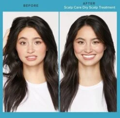 Living Proof Scalp Care Dry Scalp Treatment 100ml 5 Living Proof Scalp Care Dry Scalp Treatment 100ml -L'Oreal Verkoop scalp care dry scalp sfeerfoto 2