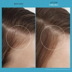 Living Proof Scalp Care Revitalizing Treatment 73ml -L'Oreal Verkoop scalp care revitalizing treatment 5